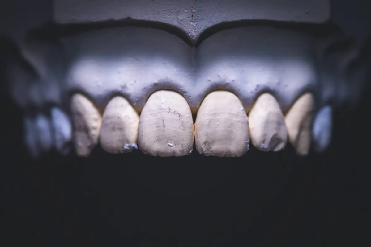 Digital Smile Design в Турции – проектирование улыбки 2025
