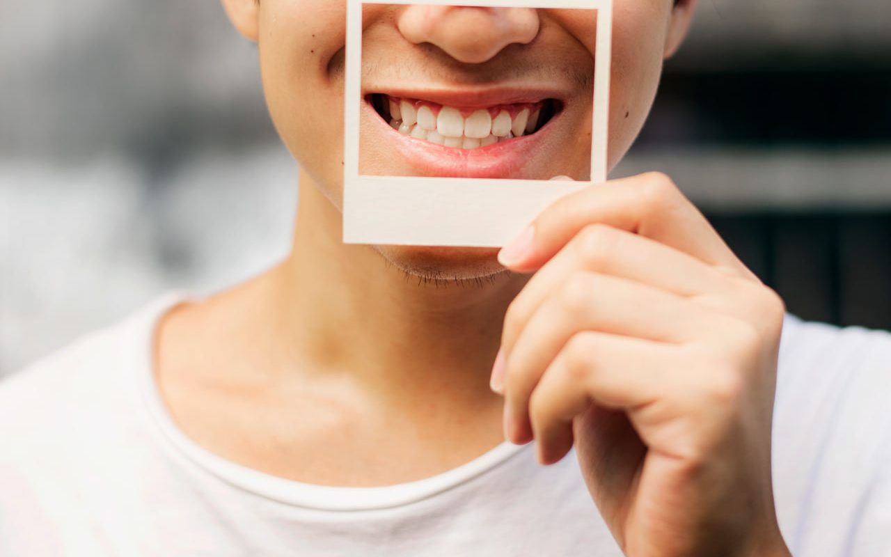 Стоимость Digital Smile Design в Турции в 2025 году