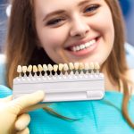 Эстетика улыбки Турция: виниры или отбеливание?
